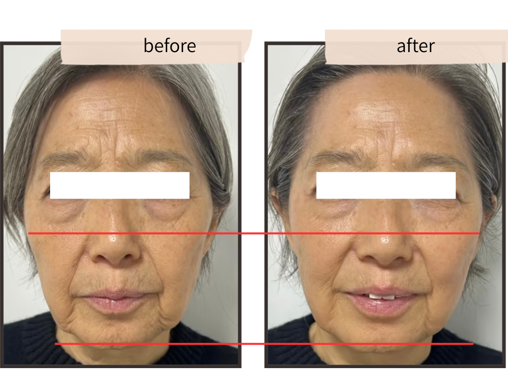 重力と脂肪の実例