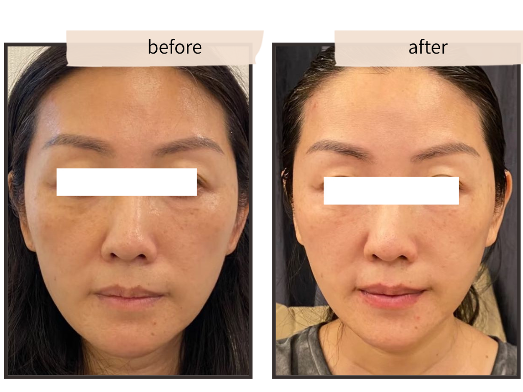 重力と脂肪の実例